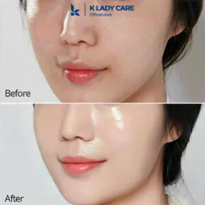 Serum Retinol, Chống lão hóa